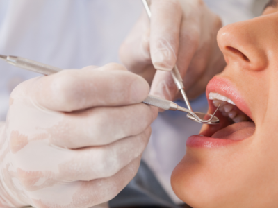 【笑気吸入鎮静法】笑気ガスは恐怖や不安、緊張を和らげる効果があります。